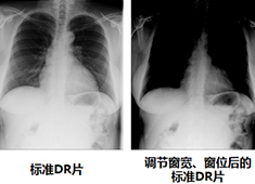 影响DR图像质量的因素有哪些方面