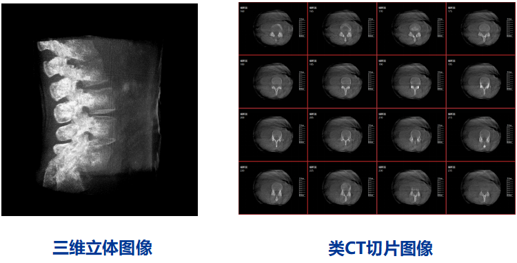 三维C臂图像