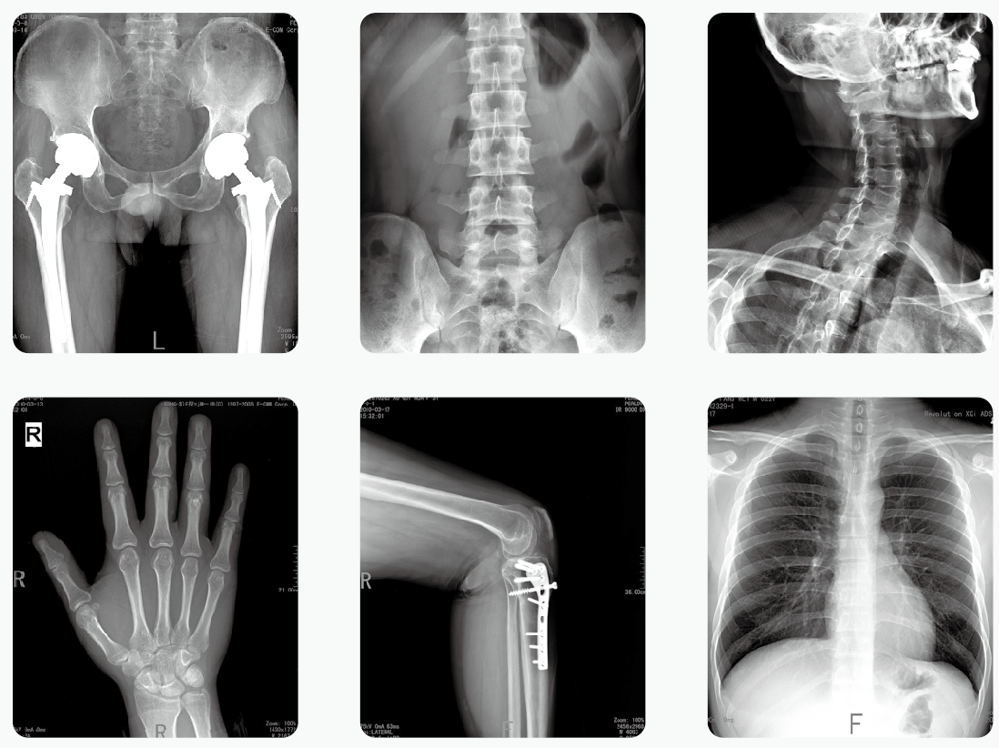 医用X光机检查影像