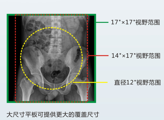 动态DR成像视野