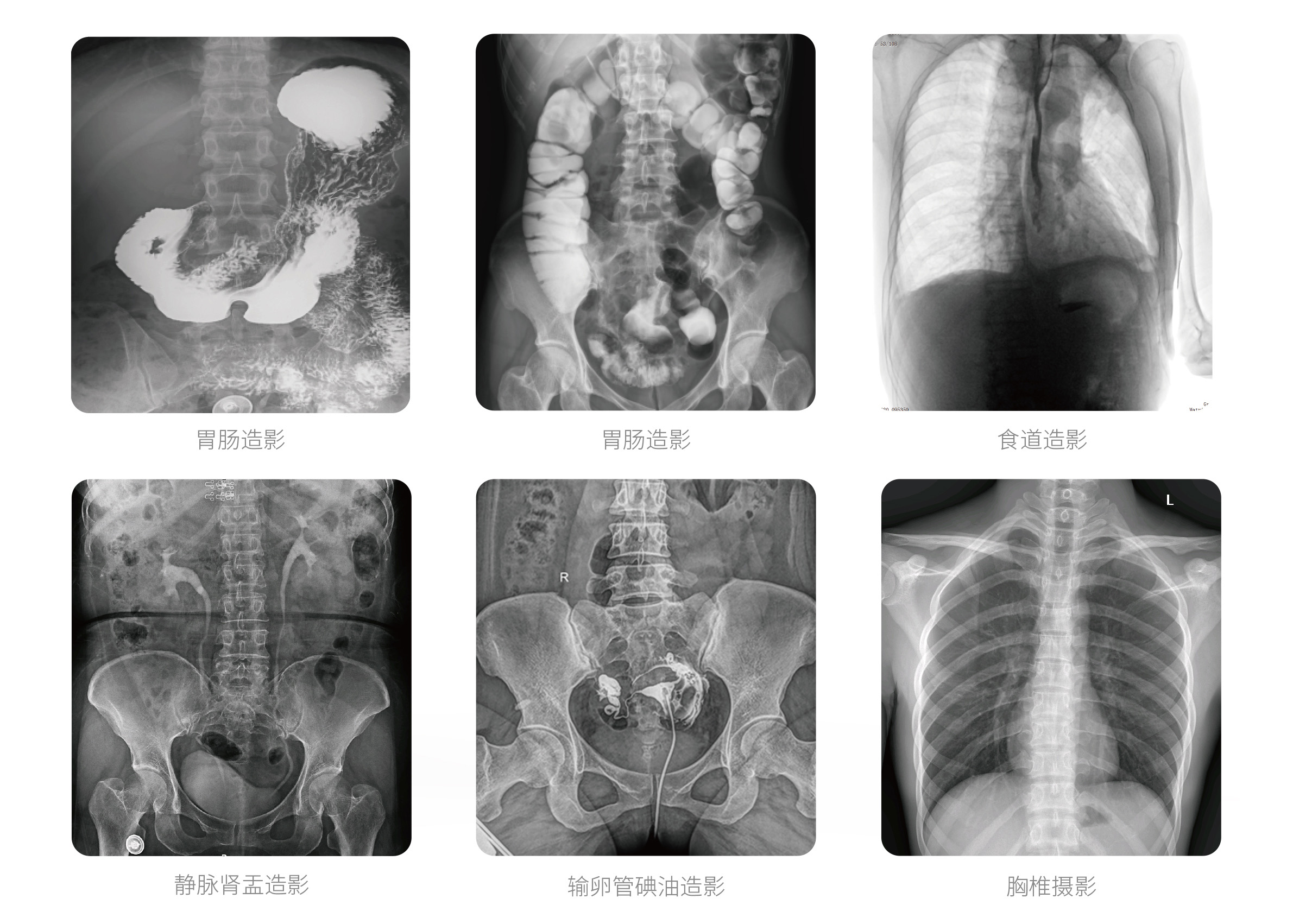 PLX8500E动态U臂DR临床影像