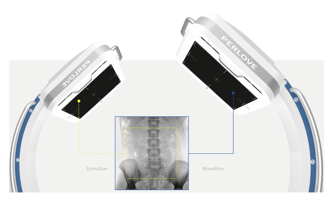 大平板一体式C形臂大视野