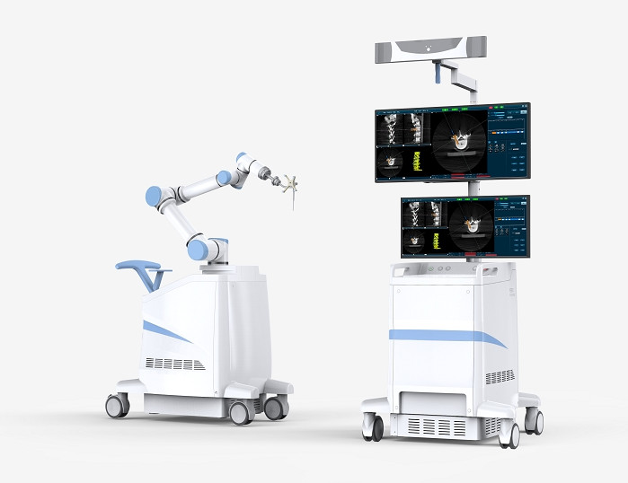 骨科导航机器人