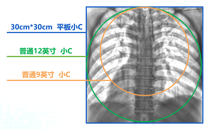 C形臂图像