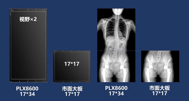 儿童DR拍片不拼接